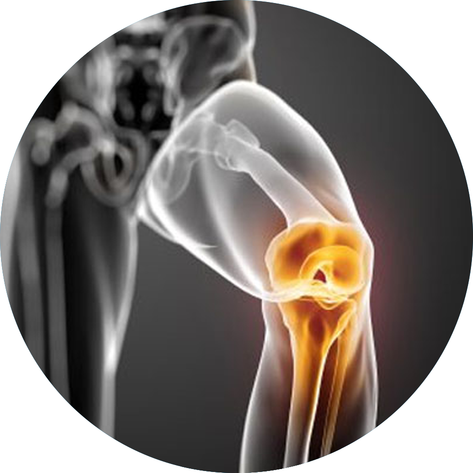 Osteotomías